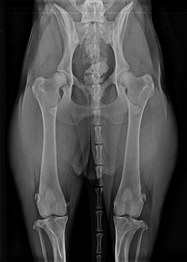 Radiographie de hanches d’un AS