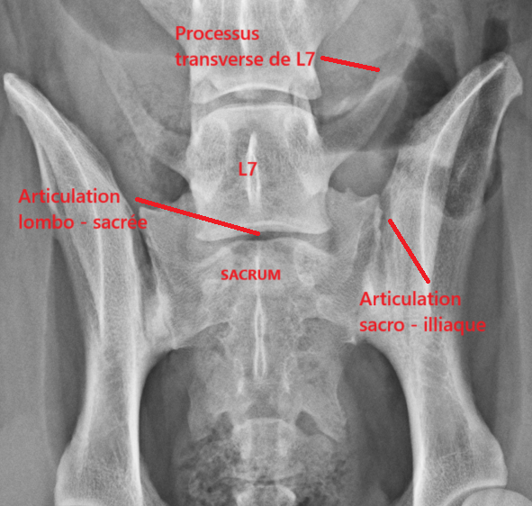 Radiographie du bassin : anatomie normale